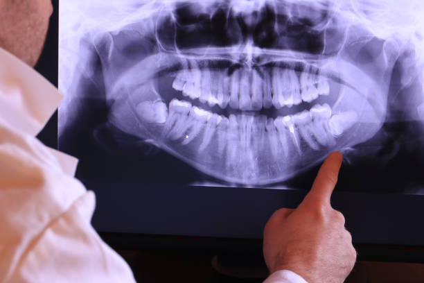 Best Emergency Dental Extractions in Nassau Bay, TX