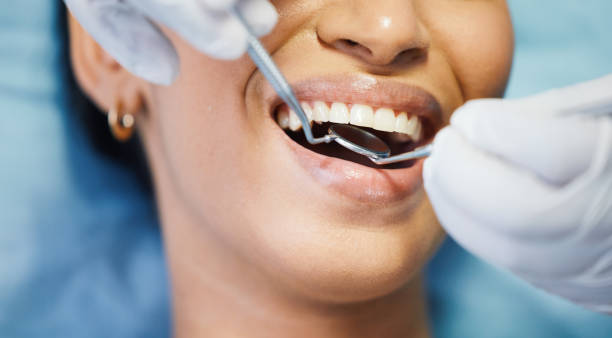 Best Emergency Dentist for Lost Fillings or Crowns in Nassau Bay, TX