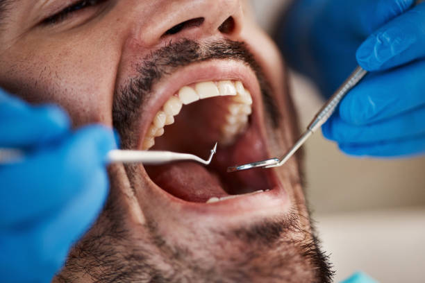 Best Urgent Dental Care for Toothache in Nassau Bay, TX